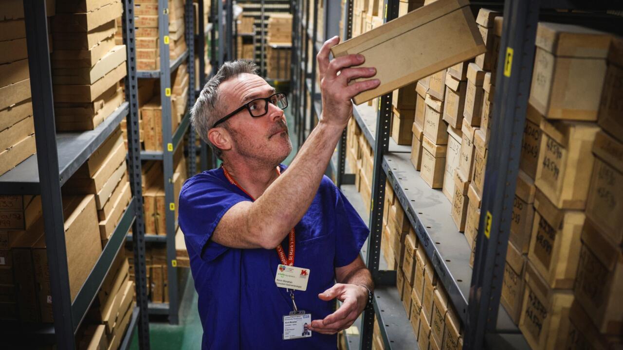Researchers hope that examining the samples and cross-sections from their bowel cancer archive over the decades will help determine increasing numbers of younger people worldwide are being diagnosed