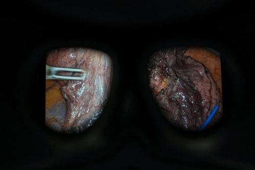 Training a new generation of UK surgeons using robots